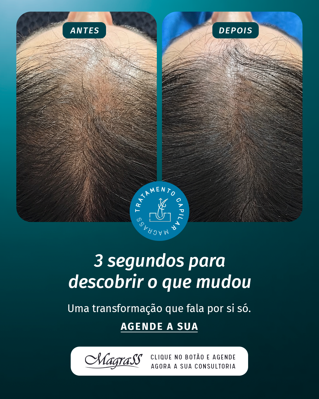Resultado 1, Protocolo M Hair