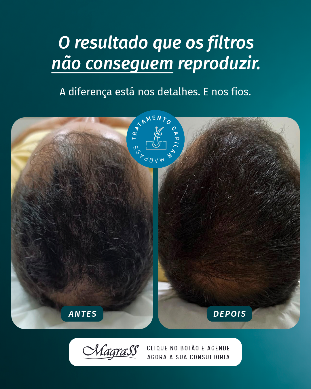 Resultado 3, Protocolo M Hair