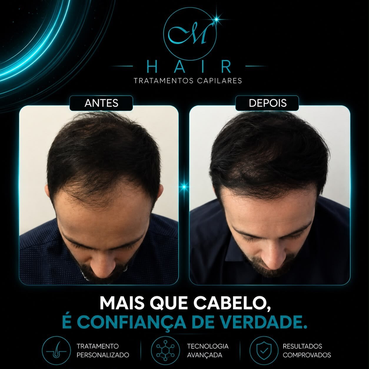 Resultado 5, Protocolo M Hair