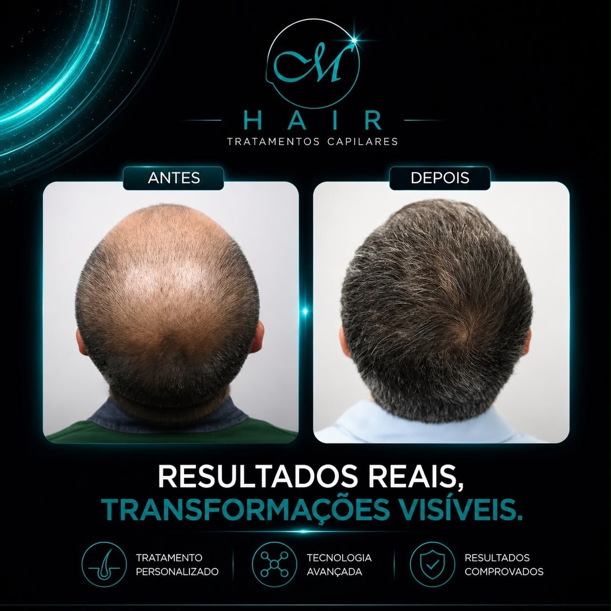 Resultado 6, Protocolo M Hair