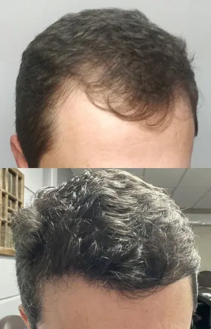 Resultado 8, Protocolo M Hair